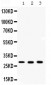 Anti-ca2 Picoband Antibody