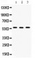 Anti-TCP1 beta Picoband Antibody