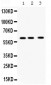 Anti-TCP1 theta Picoband Antibody