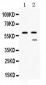 Anti-TAFI/CPB2 Picoband Antibody