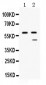 Anti-TAFI/CPB2 Picoband Antibody