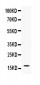 Anti-IFN gamma Antibody