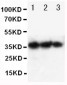 Anti-EPO Antibody