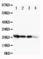 Anti-FGF1 Antibody