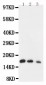 Anti-IL-7 Antibody