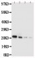 Anti-IL-18 Antibody