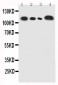 Anti-CEA Antibody