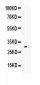 Anti-IL-17 Antibody