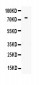 Anti-human Transferrin Antibody