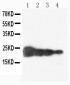 Anti-Growth Hormone Antibody