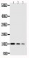 Anti-NGF/NGF beta Antibody