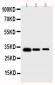 Anti-Survivin Antibody