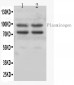 Anti-Angiostatin K1-3 Antibody