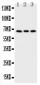 Anti-CD30/TNFRSF8 Antibody