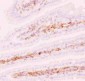 Anti-P GlycoProtein Antibody