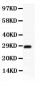 Anti-SCP3 Antibody