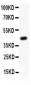 Anti-TIE2 Antibody