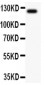 Anti-TIE2 Antibody