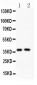 Anti-PD-1 Antibody