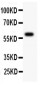 Anti-ATM Antibody