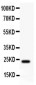 Anti-Claudin 5 Antibody