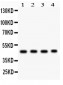 Anti-MBD2 Antibody