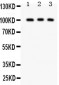 Anti-CD146 Antibody