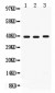 Anti-Midkine Antibody