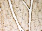 Anti-SERCA1 ATPase Antibody