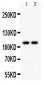 Anti-SERCA1 ATPase Antibody