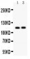 Anti-SERCA2 ATPase Antibody