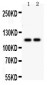 Anti-ATP2A3 Antibody