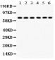 Anti-PKC Delta Antibody