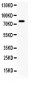 Anti-FE65 Antibody