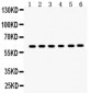 Anti-EAAT2 Antibody