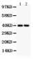 Anti-SFRP4 Antibody