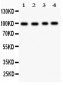 Anti-Synaptopodin Antibody