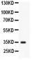 Anti-liver Arginase Antibody