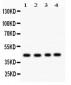 Anti-TSG101 Antibody