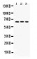 Anti-OPN Antibody