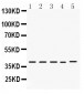 Anti-DMRT1 Antibody