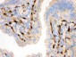 Anti-FABP4 Antibody