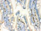 Anti-FABP4 Antibody