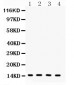 Anti-FABP4 Antibody