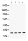 Anti-NM23A Antibody