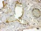 Anti-Thrombin Receptor Antibody