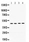 Anti-Thrombin Receptor Antibody