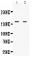 Anti-RIP140 Antibody