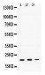 Anti-GTPase HRAS Antibody