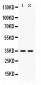 Anti-LFA3 Antibody